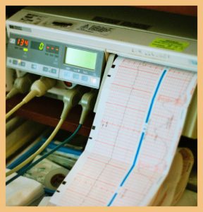 Diagnostic machine signifying resource optimisation in hospitals